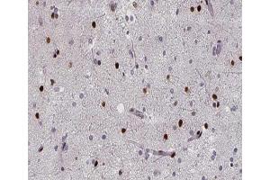 ABIN6267394 at 1/200 staining human brain tissue sections by IHC-P. (RPA2 Antikörper  (pThr21))