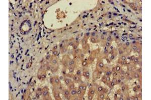 Immunohistochemistry of paraffin-embedded human liver tissue using ABIN7145926 at dilution of 1:100 (CCR3 Antikörper  (AA 306-355))