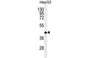 Western Blotting (WB) image for anti-Retinol Dehydrogenase 13 (All-Trans and 9-Cis) (RDH13) antibody (ABIN2996498) (RDH13 Antikörper)
