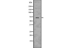 Western blot analysis of BACE using HeLa whole cell lysates (BACE1 Antikörper  (C-Term))