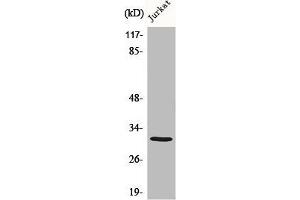 Western Blot analysis of various cells using C1QBP Polyclonal Antibody diluted at 1:1000 (C1QBP Antikörper  (Internal Region))