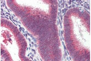 Human Uterus (formalin-fixed, paraffin-embedded) stained with Heat Shock Protein 70 (HSP70) antibody ABIN364327 at 10 ug/ml followed by biotinylated anti-mouse IgG secondary antibody ABIN481714, alkaline phosphatase-streptavidin and chromogen. (HSP70 Antikörper  (AA 1-641))