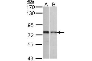 Western Blotting (WB) image for anti-Zinc Finger Protein 398 (ZNF398) (AA 358-630) antibody (ABIN467495) (ZNF398 Antikörper  (AA 358-630))