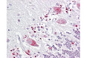 Anti-C12orf5 / TIGAR antibody IHC of human brain, cerebellum. (TIGAR Antikörper  (AA 140-190))