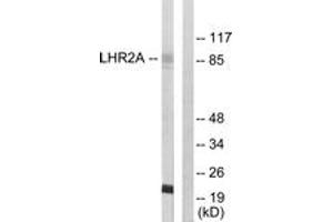 Western blot analysis of extracts from 293 cells, using LHR2A Antibody.