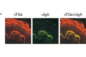 Immunofluorescence image of TGe staining in cryosection of human Skin of dermatitis herpetiformis patient. (TGM3 Antikörper)