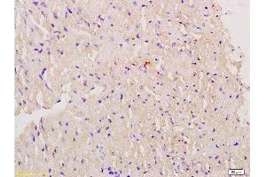 Formalin-fixed and paraffin embedded mouse myocardium labeled with Anti-Myoglobin Polyclonal Antibody, Unconjugated  at 1:200 followed by conjugation to the secondary antibody and DAB staining. (Myoglobin Antikörper  (AA 21-120))