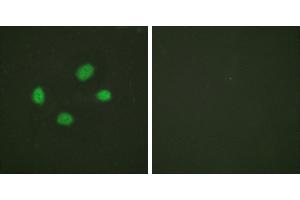 P-peptide - +Western blot analysis of extracts from COS7 cells, treated with UV (30mins), using Chk2 (Phospho-Thr383) antibody. (CHEK2 Antikörper  (pThr383))