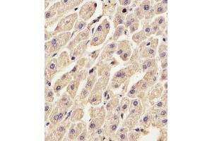 (ABIN391619 and ABIN2841538) staining ANXA2 in Human liver tissue sections by Immunohistochemistry (IHC-P - paraformaldehyde-fixed, paraffin-embedded sections).