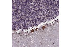 Immunohistochemical staining of human cerebellum with KCNE1L polyclonal antibody  shows strong cytoplasmic positivity in purkinje cells. (KCNE1-Like Antikörper)