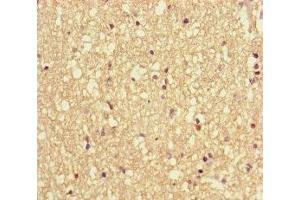 Immunohistochemistry of paraffin-embedded human brain tissue using ABIN7175471 at dilution of 1:100