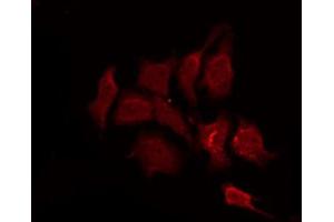 ABIN6267259 staining SK-OV3 by IF/ICC. (EGFR Antikörper  (pThr693))