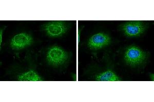ICC/IF Image LARS2 antibody [N2C1], Internal detects LARS2 protein at mitochondria by immunofluorescent analysis.