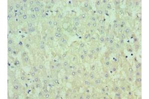 Immunohistochemistry of paraffin-embedded human liver tissue using ABIN7156797 at dilution of 1:100 (IL13RA2 Antikörper  (AA 27-343))