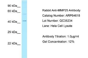 Western Blotting (WB) image for anti-Matrix Metallopeptidase 25 (MMP25) (Middle Region) antibody (ABIN2789901)