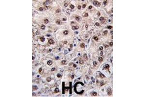 Immunohistochemistry (IHC) image for anti-Phosphatidylethanolamine N-Methyltransferase (PEMT) antibody (ABIN2995586) (PEMT Antikörper)