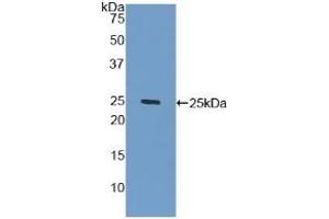 Detection of Recombinant GLb, Human using Polyclonal Antibody to Galactosidase Beta (GLb) (GLB1 Antikörper  (AA 68-219))