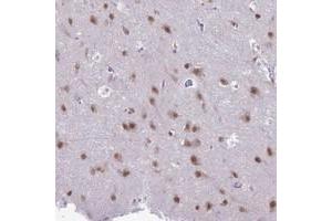 Immunohistochemical staining of human cerebral cortex with NOVA2 polyclonal antibody  shows moderate nuclear positivity in neuronal cells at 1:20-1:50 dilution.