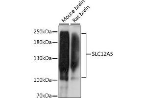 Western blot analysis of extracts of various cell lines, using SLC12 antibody (ABIN7270396) at 1:1000 dilution. (KCC2 Antikörper  (AA 945-1025))