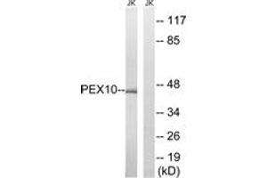 Western blot analysis of extracts from Jurkat cells, using PEX10 Antibody. (PEX10 Antikörper  (AA 183-232))
