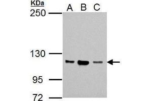 WB Image Sample (30 ug of whole cell lysate) A: Jurkat B: Raji C: K562 5% SDS PAGE antibody diluted at 1:1000 (Nucleolar Protein 1 (NOL1) (Internal Region) Antikörper)