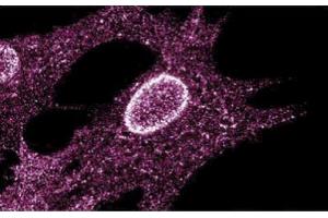 Immunofluorescent staining on Human Fibroblasts (LYN Antikörper  (AA 1-138))