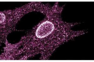 Immunofluorescent staining on Human Fibroblasts (LYN Antikörper  (AA 1-138))