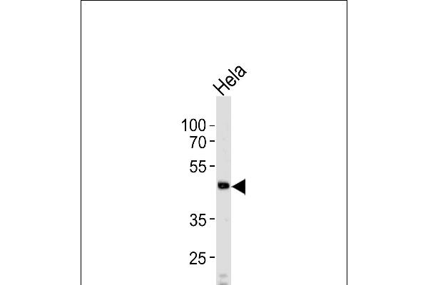 WSB2 Antikörper  (C-Term)