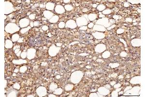IHC analysis of Sorbitol Dehydrogenase/SORD using anti-Sorbitol Dehydrogenase/SORD antibody (ABIN7602485). (SORD Antikörper  (AA 8-357))