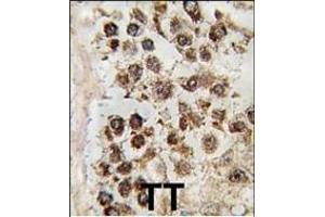 Formalin-fixed and paraffin-embedded human testis tissue reacted with MLLT10 antibody (C-term), which was peroxidase-conjugated to the secondary antibody, followed by DAB staining.