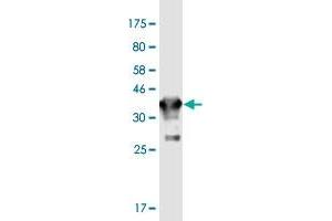 Western Blot detection against Immunogen (36. (GJD2 Antikörper  (AA 99-197))