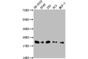 Western Blot Positive WB detected in: SH-SY5Y whole cell lysate, A549 whole cell lysate, 293 whole cell lysate, PC-3 whole cell lysate, MCF-7 whole cell lysate All lanes: ITGB1BP1 antibody at 1:2000 Secondary Goat polyclonal to rabbit IgG at 1/50000 dilution Predicted band size: 22, 17 kDa Observed band size: 22 kDa (ITGB1BP1 Antikörper  (AA 1-200))