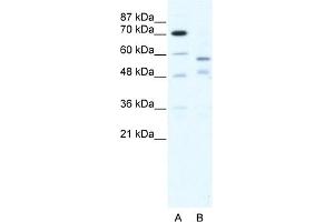 WB Suggested Anti-TRIM23 Antibody Titration:  5. (TRIM23 Antikörper  (C-Term))