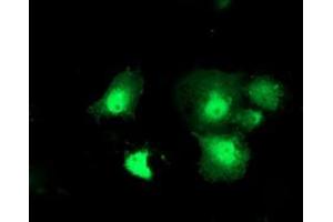 Immunofluorescence (IF) image for anti-Deoxythymidylate Kinase (Thymidylate Kinase) (DTYMK) antibody (ABIN1497918) (DTYMK Antikörper)