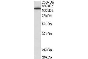 Staining of NIH3T3 lysate using Myosin-Ib antibody at 1 µg/ml (35µg protein in RIPA buffer). (Myosin IB Antikörper  (Internal Region))