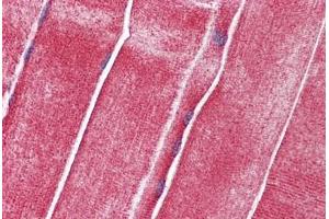 Immunohistochemistry (Formalin-fixed Paraffin-embedded Sections) (IHC (fp)) image for anti-Solute Carrier Family 36 (Proton/amino Acid Symporter), Member 2 (SLC36A2) (AA 36-85) antibody (ABIN6747086)