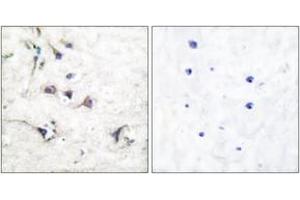Immunohistochemistry analysis of paraffin-embedded human brain tissue, using Ezrin Antibody. (Ezrin Antikörper  (AA 511-560))