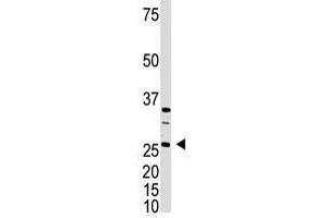 Image no. 1 for anti-Dickkopf Homolog 4 (Xenopus Laevis) (DKK4) (C-Term) antibody (ABIN357074) (DKK4 Antikörper  (C-Term))
