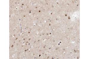 ABIN6266659 at 1/100 staining human brain tissue sections by IHC-P.