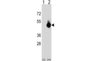 Western Blotting (WB) image for anti-G Patch Domain and Ankyrin Repeats 1 (GPANK1) antibody (ABIN3003885) (BAT4 Antikörper)