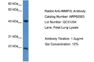 WB Suggested Anti-IMMP2L  Antibody Titration: 0. (IMMP2L Antikörper  (C-Term))