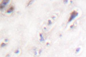 Image no. 2 for anti-Islet Amyloid Polypeptide (IAPP) antibody (ABIN271869) (Amylin/DAP Antikörper)