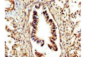 IHC image of ABIN7149978 diluted at 1:300 and staining in paraffin-embedded human lung tissue performed on a Leica BondTM system. (CTSC Antikörper  (AA 25-134))