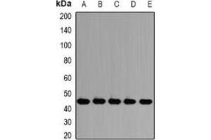 Western blot analysis of PSMD13 expression in HepG2 (A), Jurkat (B), SW620 (C), mouse testis (D), rat lung (E) whole cell lysates. (PSMD13 Antikörper)