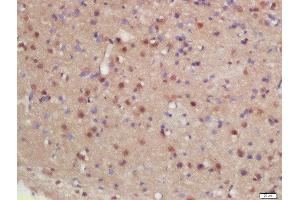 Formalin-fixed and paraffin embedded rat brain labeled with Rabbit Anti-hHR23b Polyclonal Antibody, Unconjugated (ABIN2175752) at 1:200 followed by conjugation to the secondary antibody and DAB staining (RAD23B Antikörper  (AA 24-120))