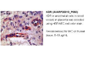 Image no. 1 for anti-VEGF Receptor 2 (VEGFR2) (N-Term) antibody (ABIN504629) (VEGFR2/CD309 Antikörper  (N-Term))