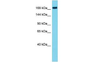 Host: Rabbit Target Name: ATAD2B Sample Type: HT1080 Whole Cell lysates Antibody Dilution: 1. (ATAD2B Antikörper  (N-Term))