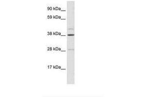 Image no. 1 for anti-Ceramide Synthase 3 (CERS3) (AA 54-103) antibody (ABIN6735903) (LASS3 Antikörper  (AA 54-103))