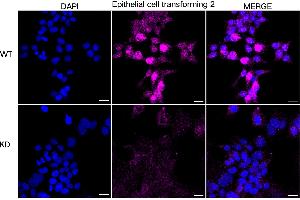 anti-Epithelial Cell Transforming Sequence 2 Oncogene (ECT2) antibody