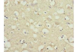 Immunohistochemistry of paraffin-embedded human brain tissue using ABIN7161221 at dilution of 1:100 (Neurexin 3 Antikörper  (AA 1584-1643))